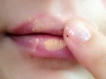 foraywhile_voluminious lips