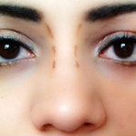 dotted  lines nose1