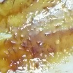 wax hair removal