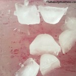 ice massage