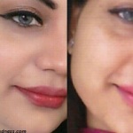 skin irregularities