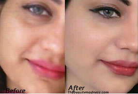 Remedies for uneven skin tone on face