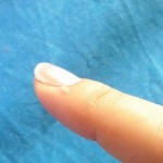 future hangnails