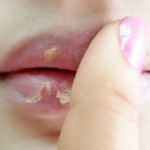 conceal_lips