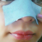 blackheads