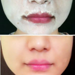 skin whitening face pack