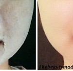skin whitening face pack