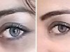 10 Easy Tips to Get Rid of Dark Circles Instantly