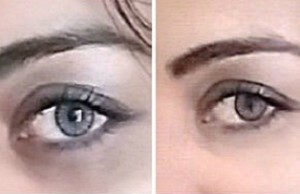 10 Easy Tips to Get Rid of Dark Circles Instantly