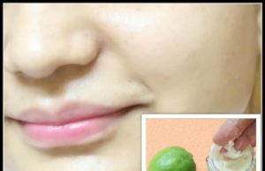 Lemon Dark Spot Remover & Whitening Cream