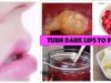 15 Lip Care Tips to Turn Dark Lips to Pink Lips Naturally| Lighten Dark Lips Fast