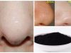5 Super-Easy Remedies to Get Rid of Blackheads Instantly