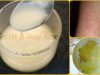 7 Best Ways to Get Rid of Body Acne