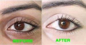 How to Remove Dark Circles Naturally in 3 Days (100% Results)