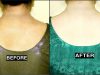 Back Scrub – For Fair, Smooth, Clear, Pigmented & Tan Free Back