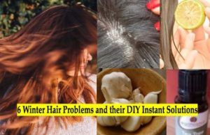 6 Winter Hair Problems and their Quick Homemade Solutions