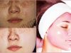 Vegetable Facial For Pigmented-free & Clear Glowing Complexion!
