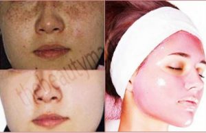 Vegetable Facial For Pigmented-free & Clear Glowing Complexion!