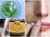 3 Magical Mask to remove Sun Tan from Face and Body Instantly