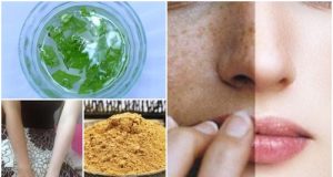 3 Magical Mask to remove Sun Tan from Face and Body Instantly