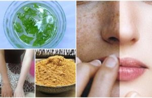 3 Magical Mask to remove Sun Tan from Face and Body Instantly