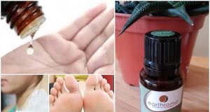 6 beauty tips with Tea Tree Oil for summer!