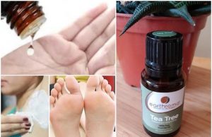 6 beauty tips with Tea Tree Oil for summer!