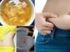 10 Tips to Lose Stomach Fat Fast and Easy