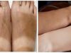 How to Remove Sun Tan from Face, Neck, Arms & Legs Instantly | thebeautymadness