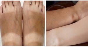 How to Remove Sun Tan from Face, Neck, Arms & Legs Instantly | thebeautymadness