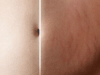 Banish stretch marks with this miracle pumpkin lotion!