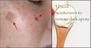 3 Facial Moisturizers You can Make at Home To remove Dark Spots