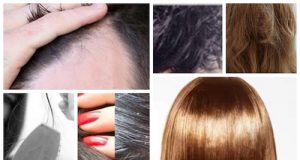 No.1 Home Remedies for Dry Hair, Split Ends, Oily Scalp, Hair Loss & Dandruff