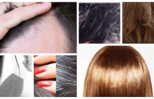No.1 Home Remedies for Dry Hair, Split Ends, Oily Scalp, Hair Loss & Dandruff