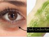 5 Quick Beauty Tips To Remove Dark Under Eye Circles