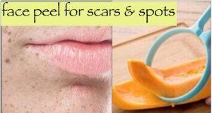 An amazing Face Peel to Fade Spots & Scars instant