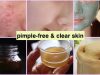 Top 5 tips for Oily skin to keep it clear & pimple-free