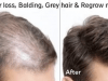 Regrow new hair | Stop hair loss | thebeautymadness