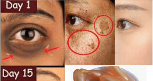 From Acne to Wrinkles: Top 10 All-Natural Remedies for Your Biggest Beauty Woes!