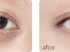 5 Pro tips to Hide Dark Circles With Makeup
