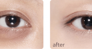 5 Pro tips to Hide Dark Circles With Makeup