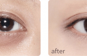 5 Pro tips to Hide Dark Circles With Makeup