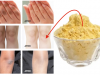 Try This Amazing Lightening Remedy for Dark Hands and Knees – See the Results for Yourself!
