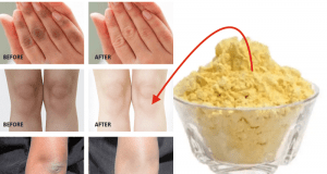 Try This Amazing Lightening Remedy for Dark Hands and Knees – See the Results for Yourself!
