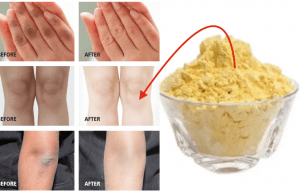 Try This Amazing Lightening Remedy for Dark Hands and Knees – See the Results for Yourself!