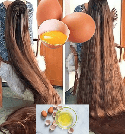 Buy Ignoty Egg Hair Oil, 200 ML Oil - Ignoty