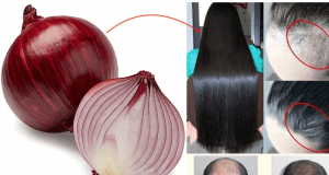 “Do you know this is the right way to use onion juice for Super Thick & Fast hair growth?”