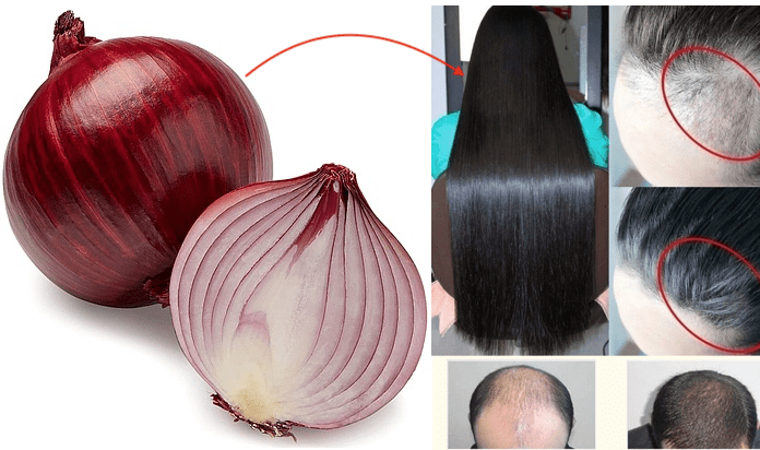 Onion Hair oil For Hair Fall Control | Hair Growth Oil | Hair Regrowth Oil |