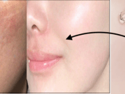 “Get Plump and Glowing Skin on a Budget: 5 Affordable Hyaluronic Acid Serums in India!”