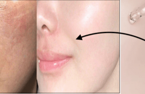 “Get Plump and Glowing Skin on a Budget: 5 Affordable Hyaluronic Acid Serums in India!”
